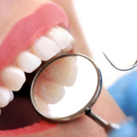 preventive-dentistry